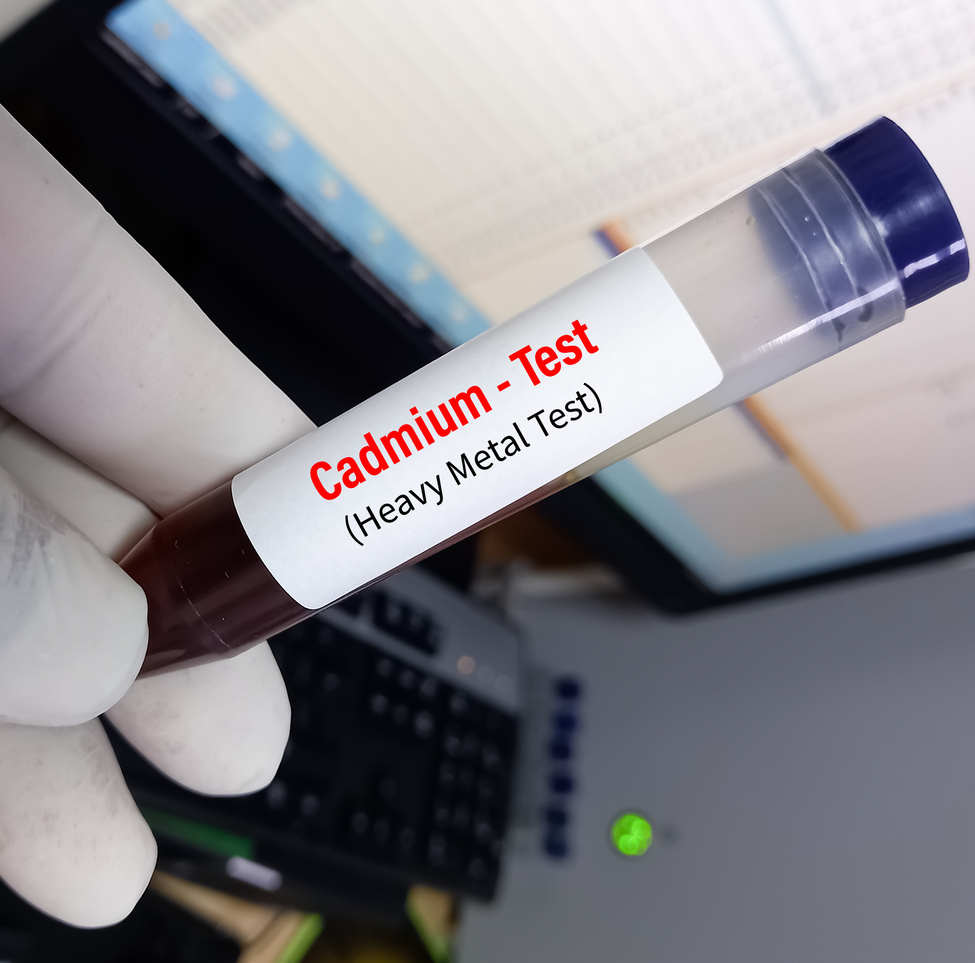 Urine sample for cadmium (heavy metal) test, toxic metal.